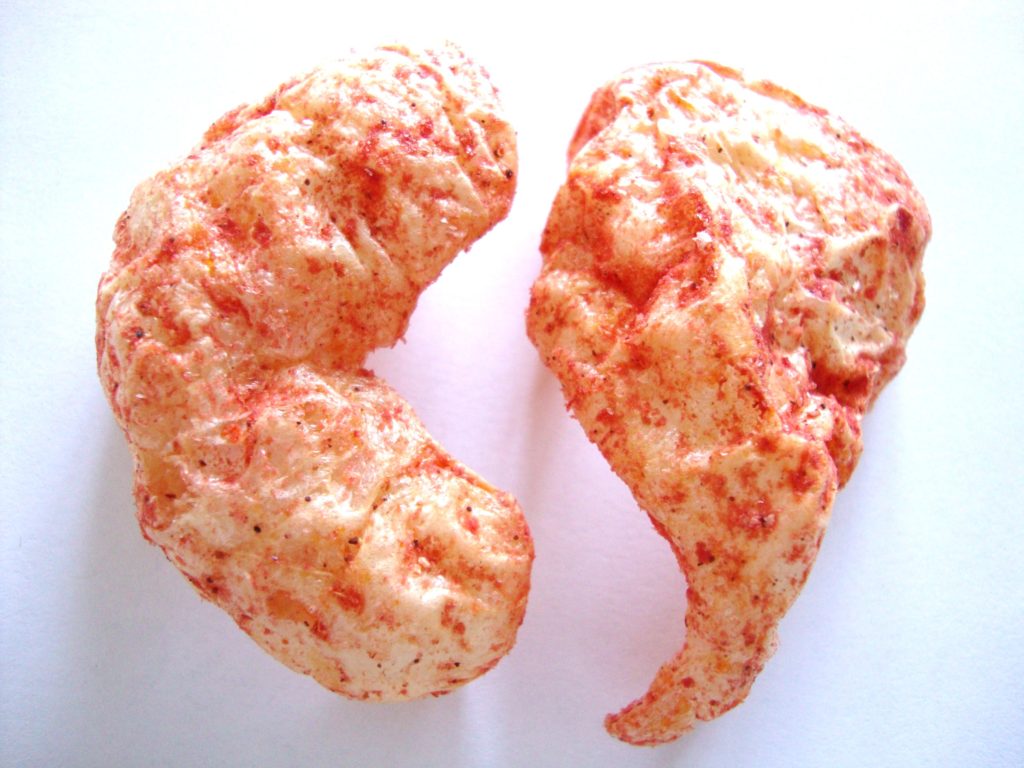 Click to Buy BAKEN-ETS Hot 'N Spicy Flavored Fried Pork Skins